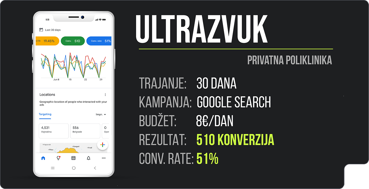 Ultrazvuk
